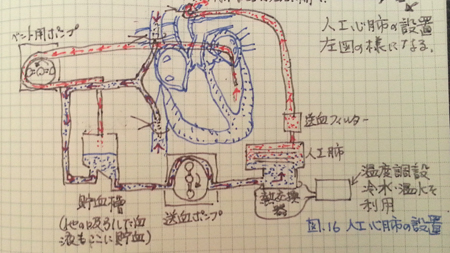人工心肺の図